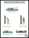 Thumbnail image of: Iliotibial Band Syndrome Exercises: Illustration, page 2