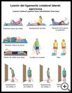 Thumbnail image of: Lateral Collateral Ligament Sprain Exercises: Illustration, page 1
