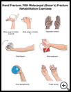 Thumbnail image of: Hand Fracture: Fifth Metacarpal (Boxer's) Fracture Exercises, Illustration