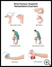 Thumbnail image of: Wrist Fracture, Scaphoid, Exercises: Illustration, Page 1