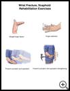 Thumbnail image of: Wrist Fracture, Scaphoid, Exercises: Illustration, Page 2