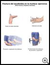 Thumbnail image of: Wrist Fracture, Scaphoid, Exercises: Illustration, Page 2