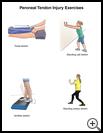 Thumbnail image of: Peroneal Tendon Injury Exercises: Illustration, page 1