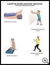 Thumbnail image of: Peroneal Tendon Injury Exercises: Illustration, page 1
