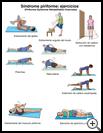 Thumbnail image of: Piriformis Syndrome Exercises: Illustration