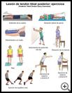 Thumbnail image of: Posterior Tibial Tendon Injury Exercises: Illustration