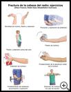 Thumbnail image of: Elbow Fracture, Radial Head, Exercises: Illustration