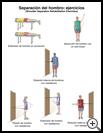 Thumbnail image of: Shoulder Separation Exercises: Illustration, page 3