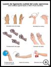 Thumbnail image of: Skier's Thumb (Ulnar Collateral Ligament Sprain) Exercises: Illustration