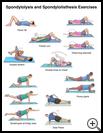 Thumbnail image of: Spondylolysis and Spondylolisthesis Exercises: Illustration