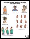 Thumbnail image of: Ulnar Neuropathy Exercises: Illustration, page 1