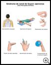 Thumbnail image of: Ulnar Neuropathy Exercises: Illustration, page 2