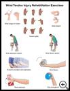 Thumbnail image of: Wrist Tendon Injury Exercises: Illustration