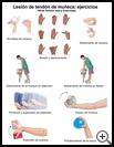 Thumbnail image of: Wrist Tendon Injury Exercises: Illustration