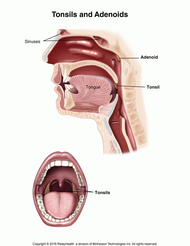 Tonsils and Adenoids: Illustration