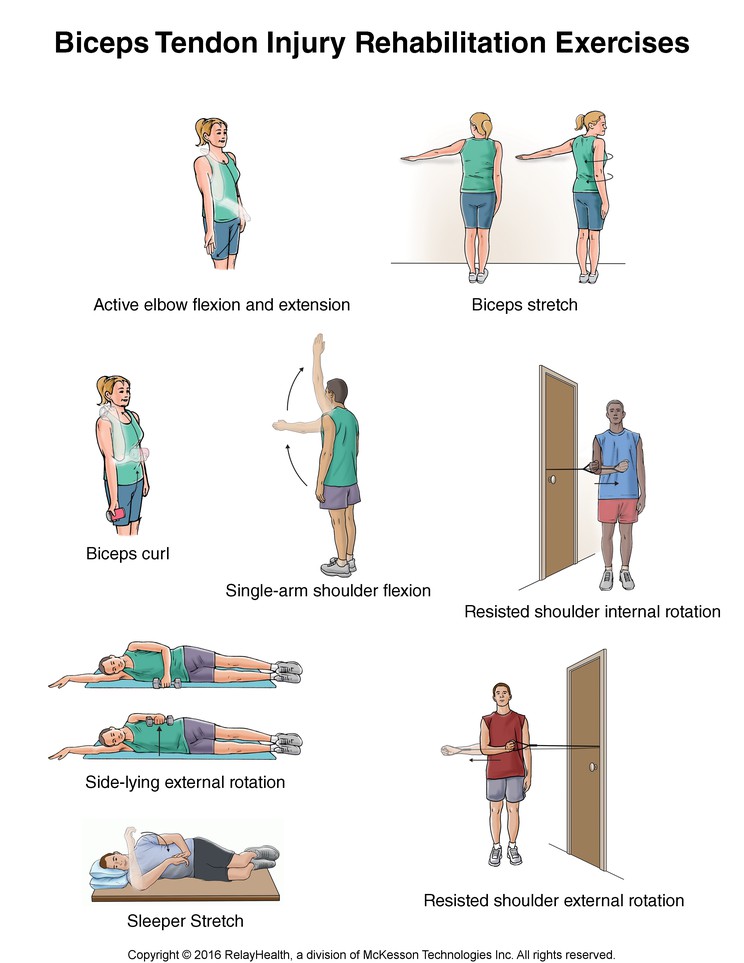 Biceps Tendon Injury Exercises: Illustration