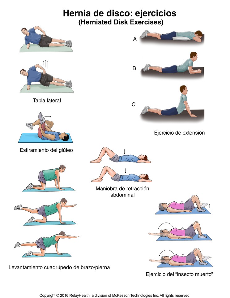 Herniated Disk Exercises: Illustration