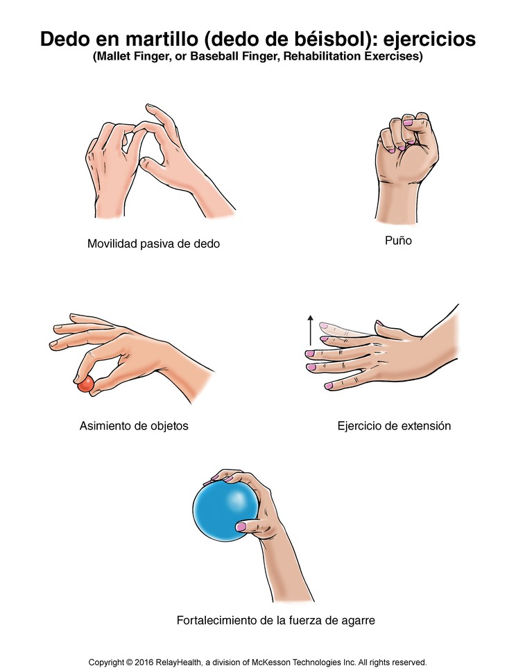 Mallet Finger (Baseball Finger) Exercises: Illustration