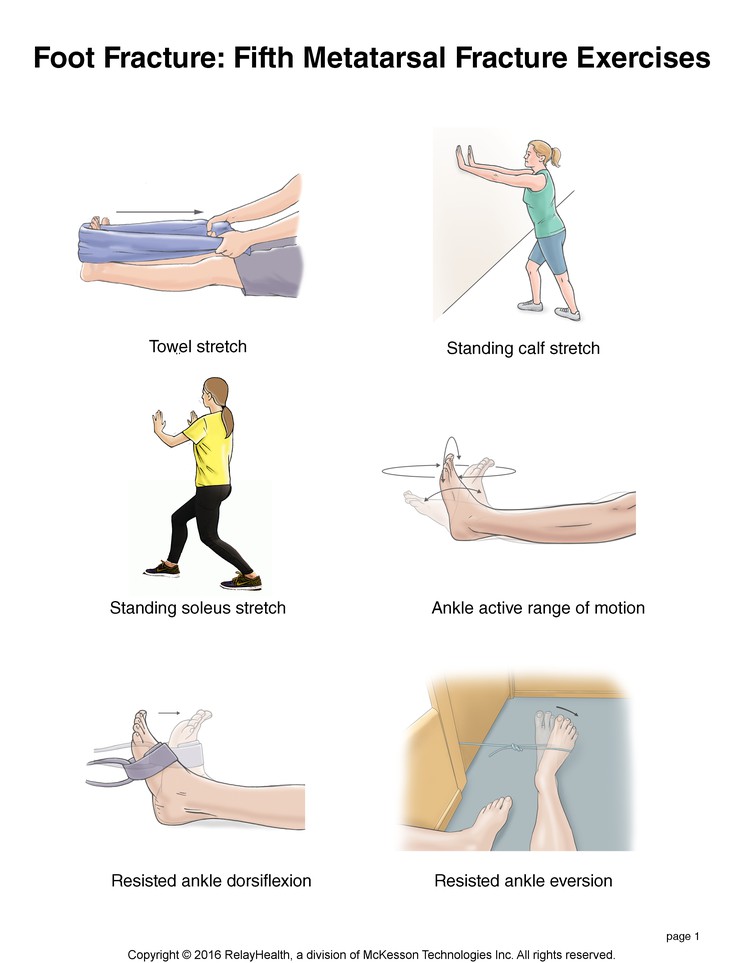 Foot Fracture, Fifth Metatarsal Fracture Exercises: Illustration, page 1