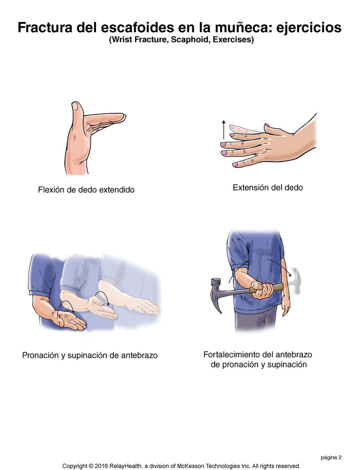 Wrist Fracture, Scaphoid, Exercises: Illustration, Page 2