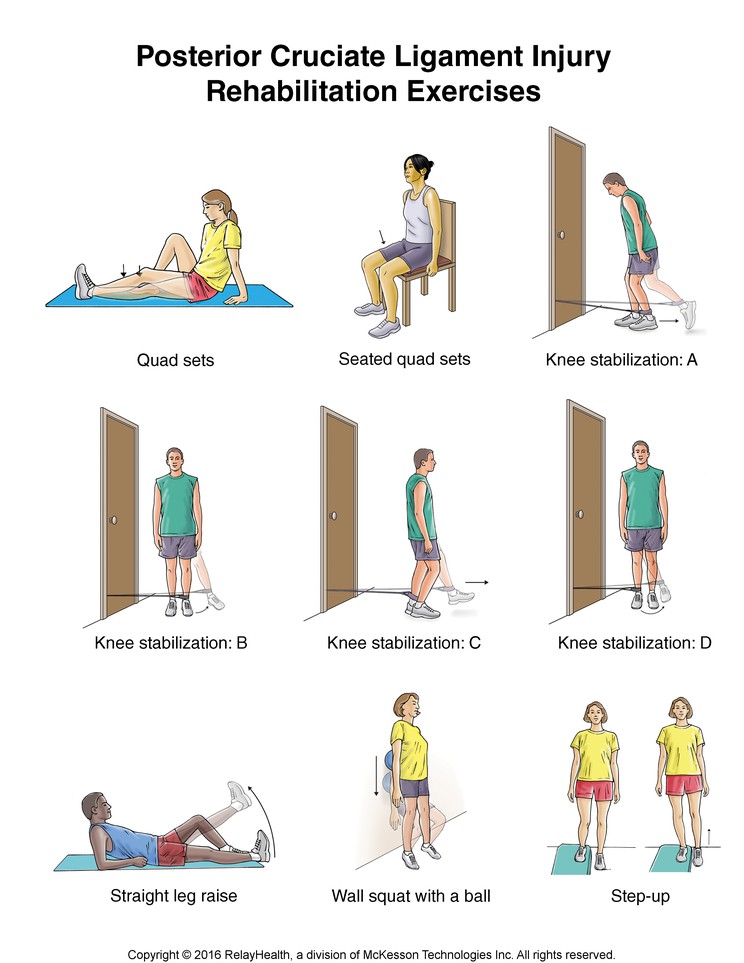 Posterior Cruciate Ligament Injury Exercises: Illustration