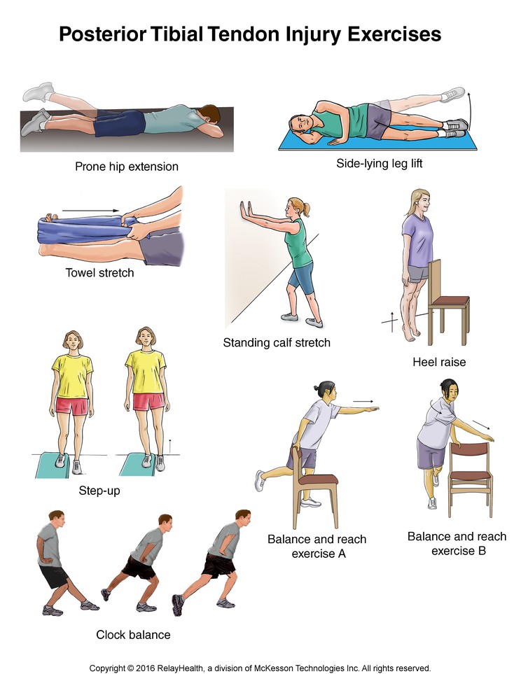 Posterior Tibial Tendon Injury Exercises: Illustration