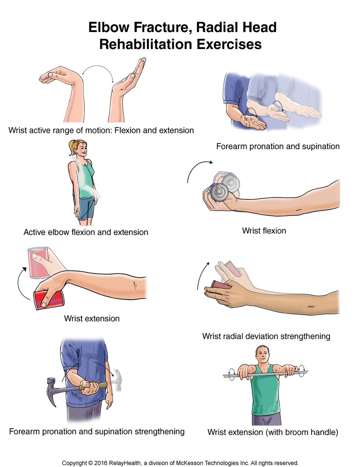 Elbow Fracture, Radial Head, Exercises: Illustration