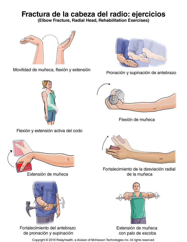 Elbow Fracture, Radial Head, Exercises: Illustration