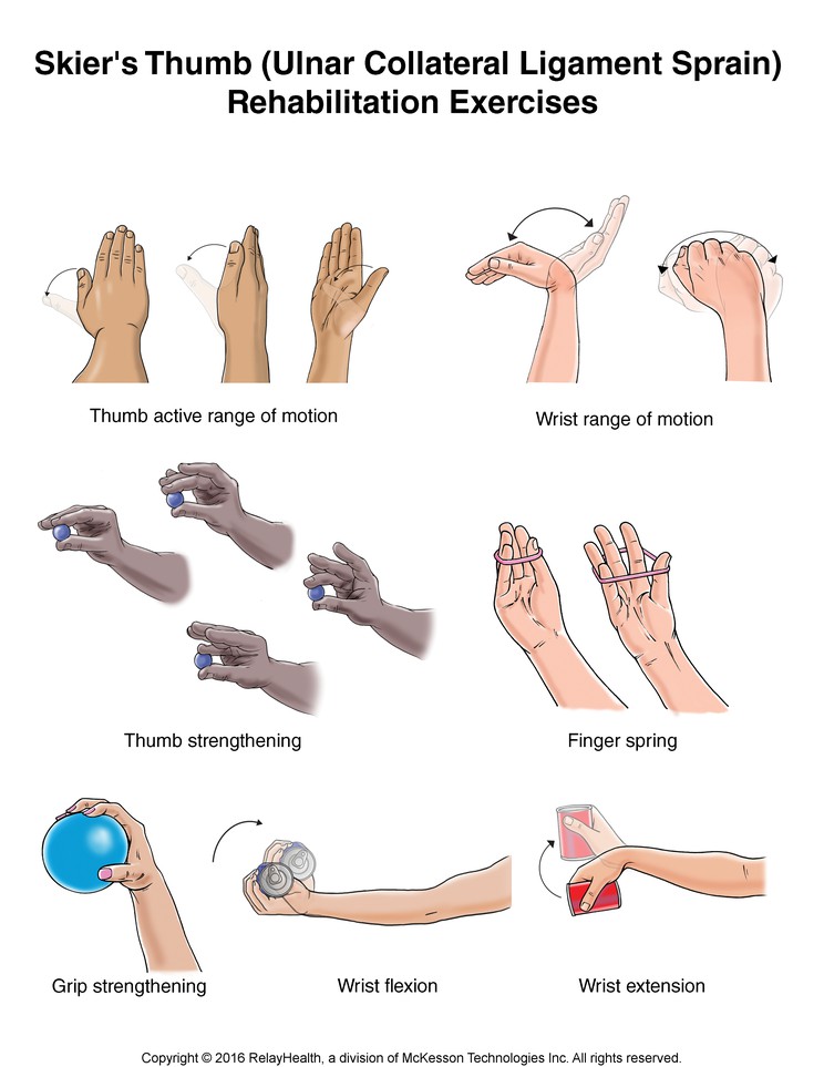 Skier's Thumb (Ulnar Collateral Ligament Sprain) Exercises: Illustration