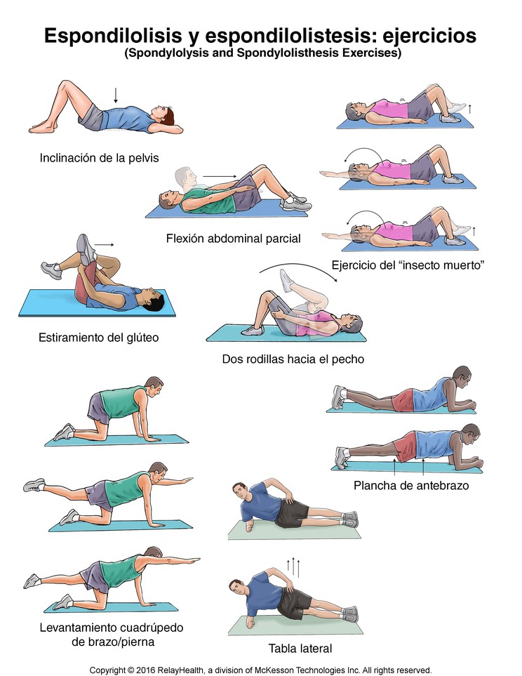 Spondylolysis and Spondylolisthesis Exercises: Illustration