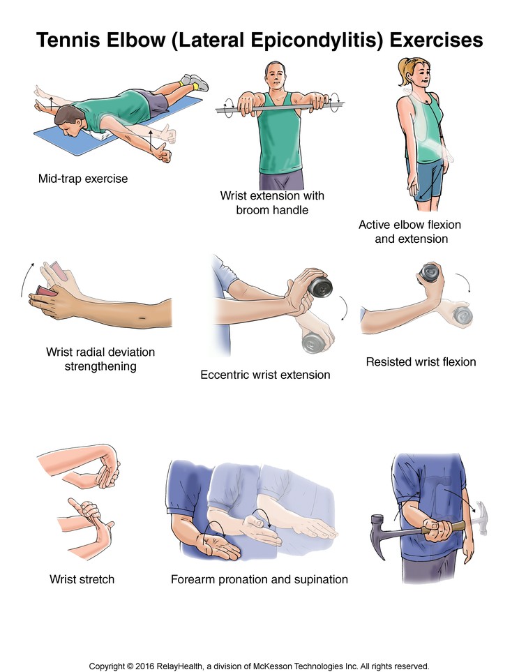 Tennis Elbow (Lateral Epicondylitis) Exercises: Illustration