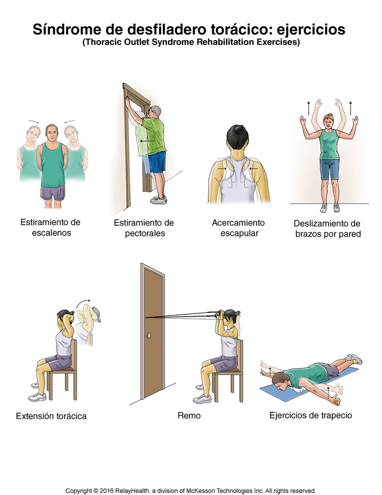 Thoracic Outlet Syndrome Exercises: Illustration