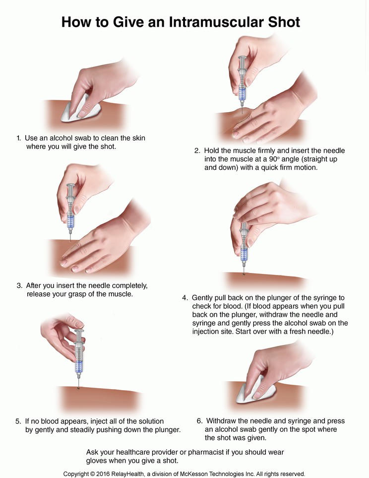 Intramuscular Shot, How to Give: Illustration