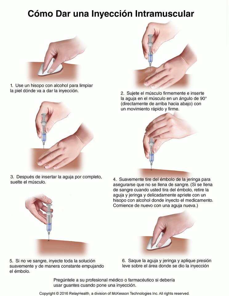 Intramuscular Shot, How to Give: Illustration