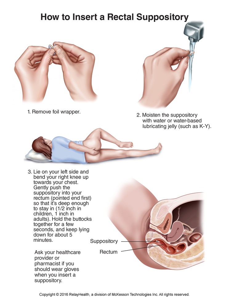 Rectal Suppository, How to Insert: Illustration