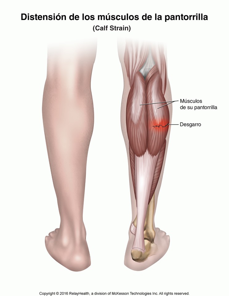 Calf Strain: Illustration
