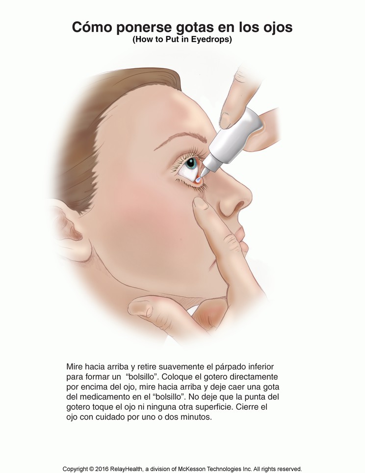 Eyedrops, How to Put in Eye: Illustration