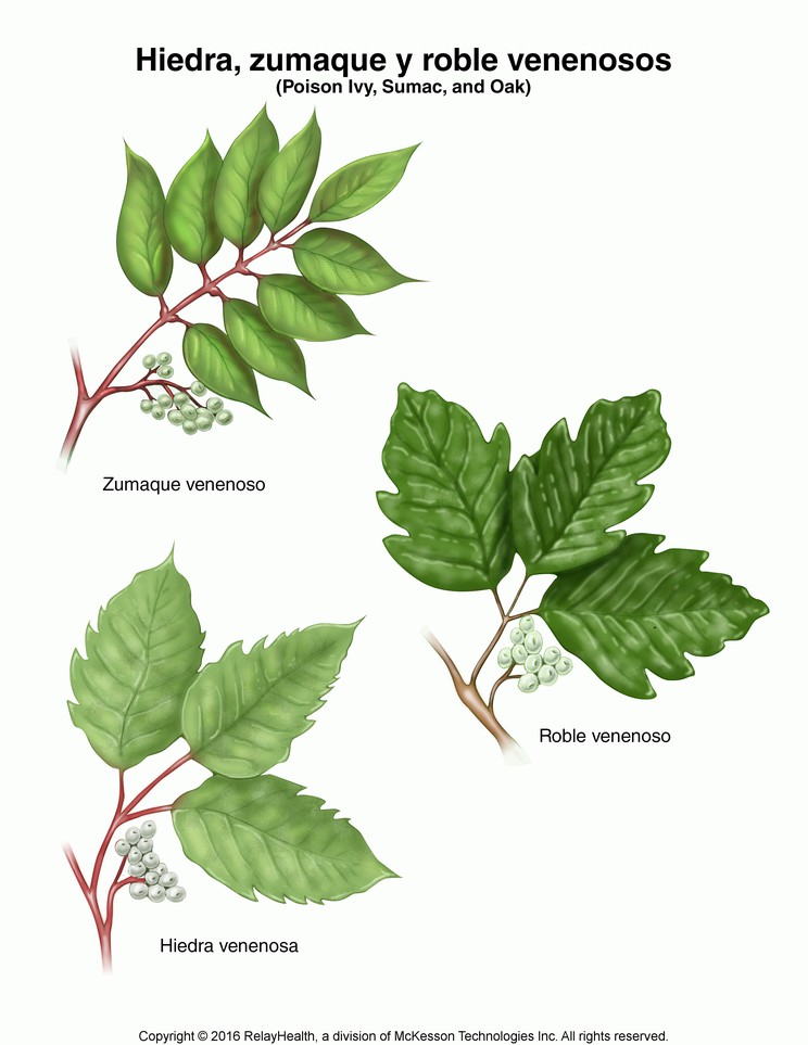 Poison Ivy, Sumac, and Oak: Illustration