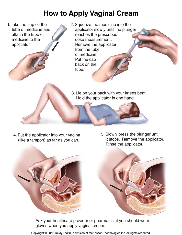 Vaginal Cream, How to Use: Illustration